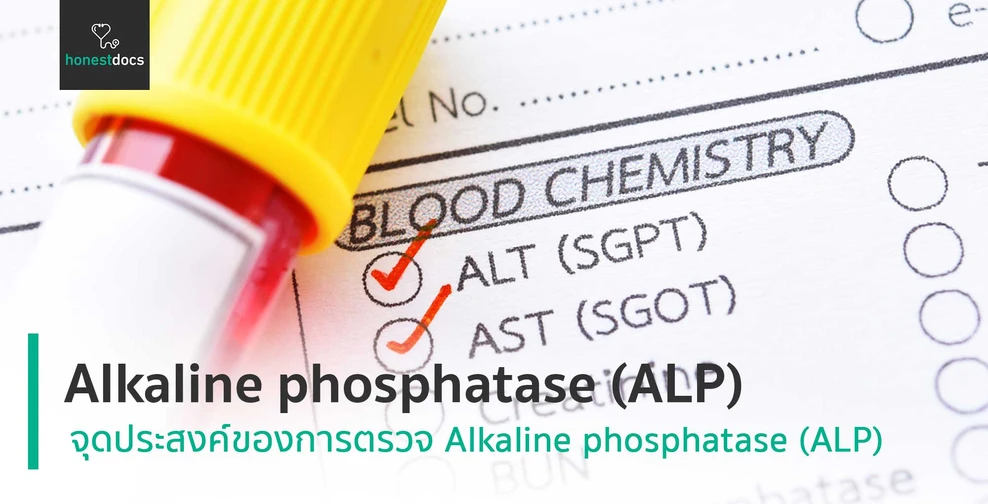 Alkaline phosphatase (ALP)