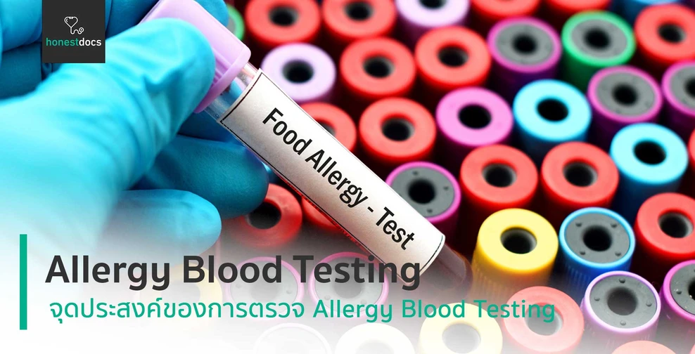 Allergy Blood Testing