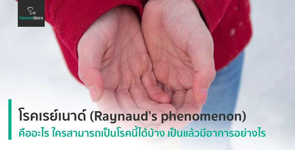 โรคเรย์เนาด์ (Raynaud's phenomenon)