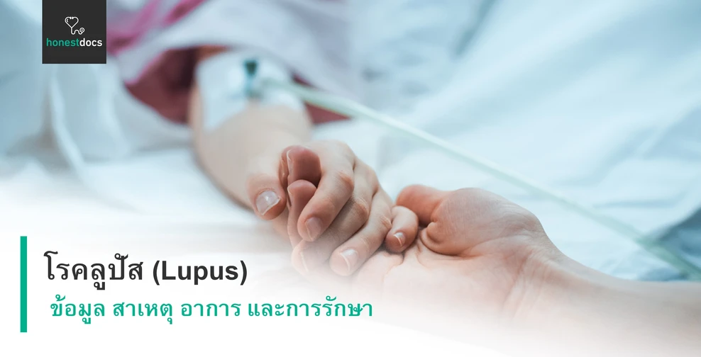 โรคลูปัส คืออะไร? ข้อมูล สาเหตุ อาการ การรักษา และป้องกัน