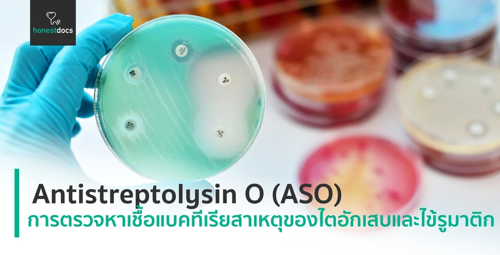Antistreptolysin O (ASO)