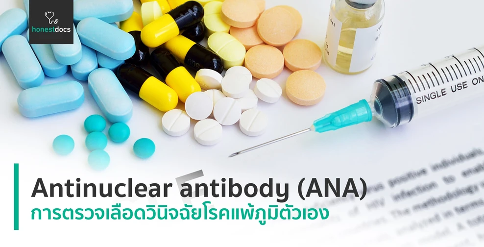 Antinuclear antibody (ANA)