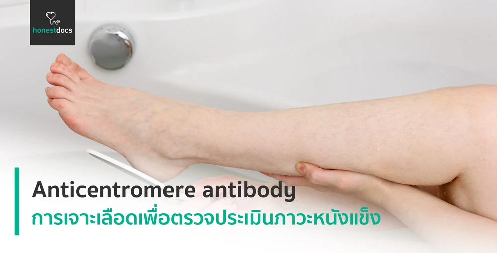 Anticentromere antibody