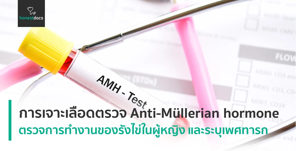 Anti-Müllerian hormone