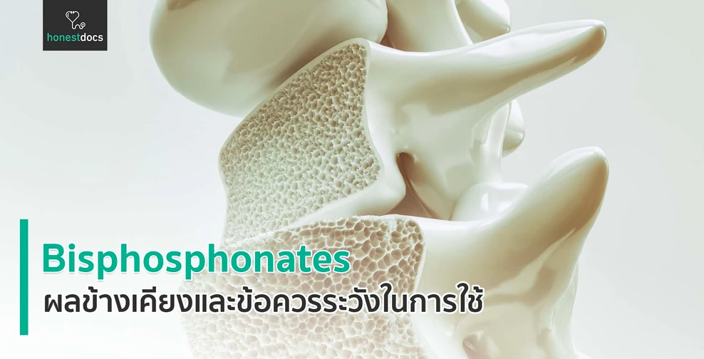ยากลุ่มบิสฟอสโฟเนตส์ (Bisphosphonates)