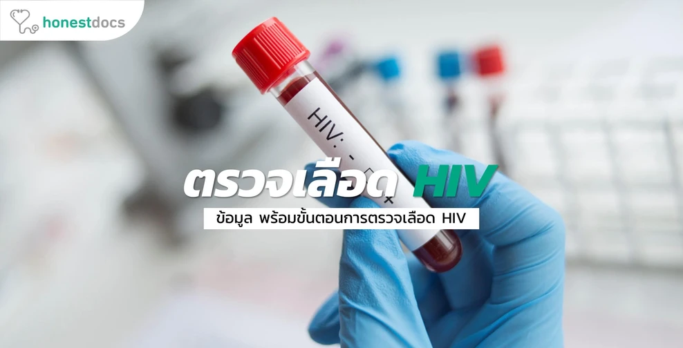 ตรวจเลือด HIV ขั้นตอนเป็นอย่างไร? เมื่อไหร่ถึงควรไปตรวจ?