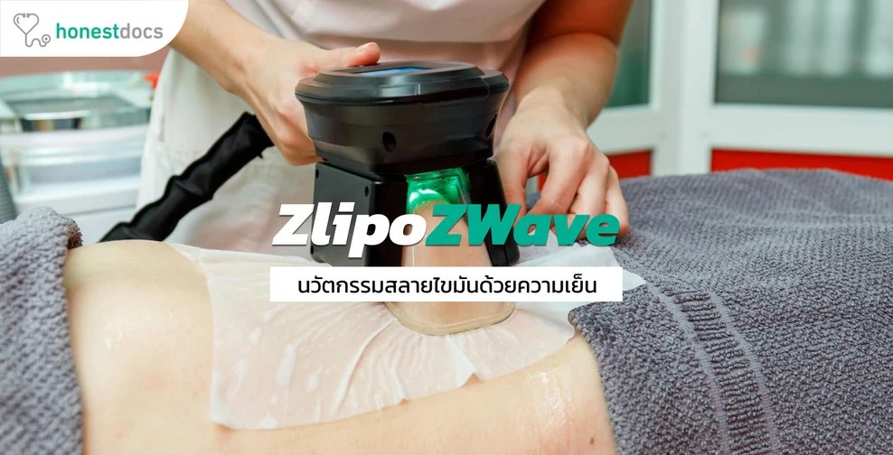 Z Lipo & Z Wave เทคนิคการสลายไขมันด้วยความเย็นจุดเยือกแข็ง