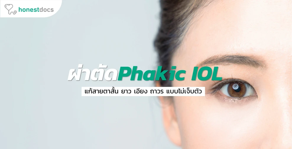 ผ่าตัดเสริมเลนส์ Phakic IOL รักษาสายตาสั้น ยาว เอียง คืออะไร อันตรายไหม?
