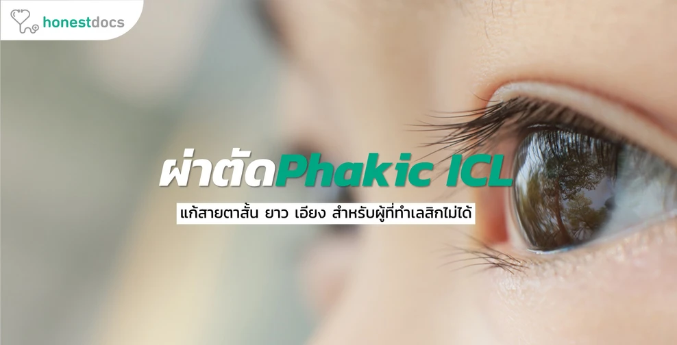 ผ่าตัดเสริมเลนส์ Phakic ICL คืออะไร อันตรายไหม?