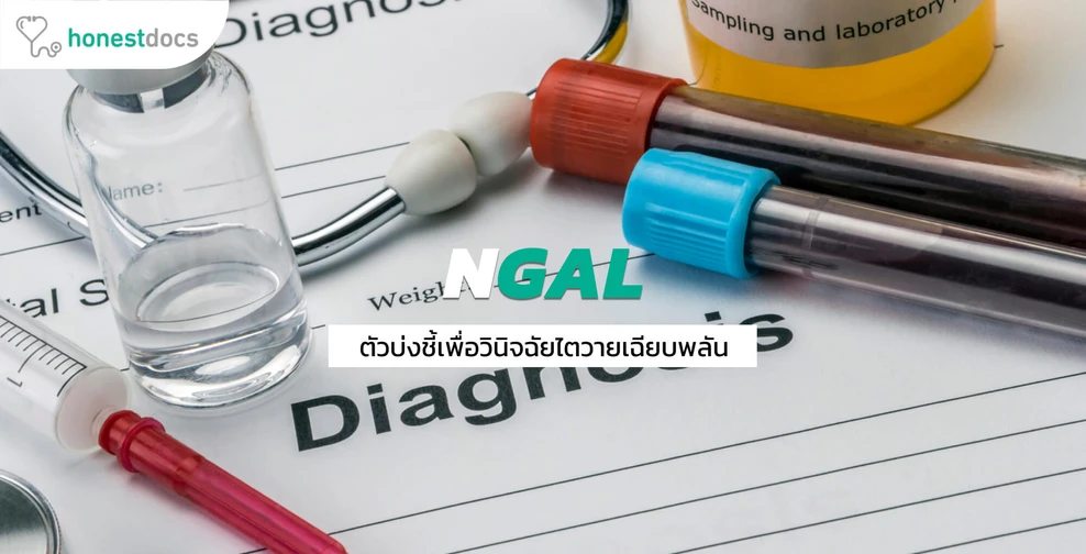 NGAL ตัวบ่งชี้ทางชีวภาพเพื่อช่วยวินิจฉัยและติดตามผลการรักษาผู้ป่วยไตวาย