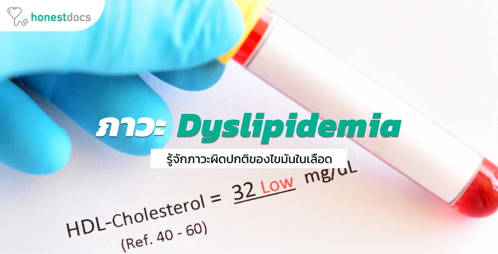 Dyslipidemia คืออะไร? ข้อมูล อาการ สาเหตุ วิธีรักษา และป้องกัน