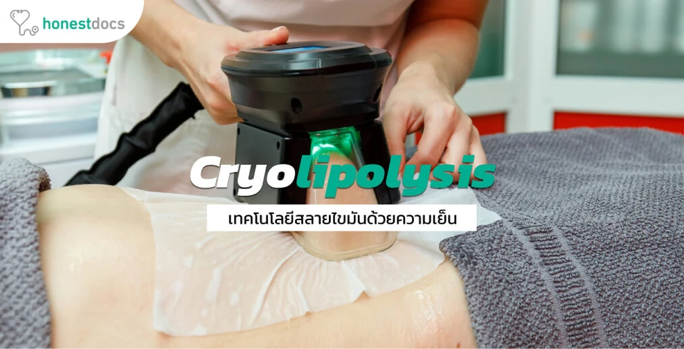 ทำความรู้จักเทคโนโลยีสลายไขมันด้วยความเย็น (Cryolipolysis)