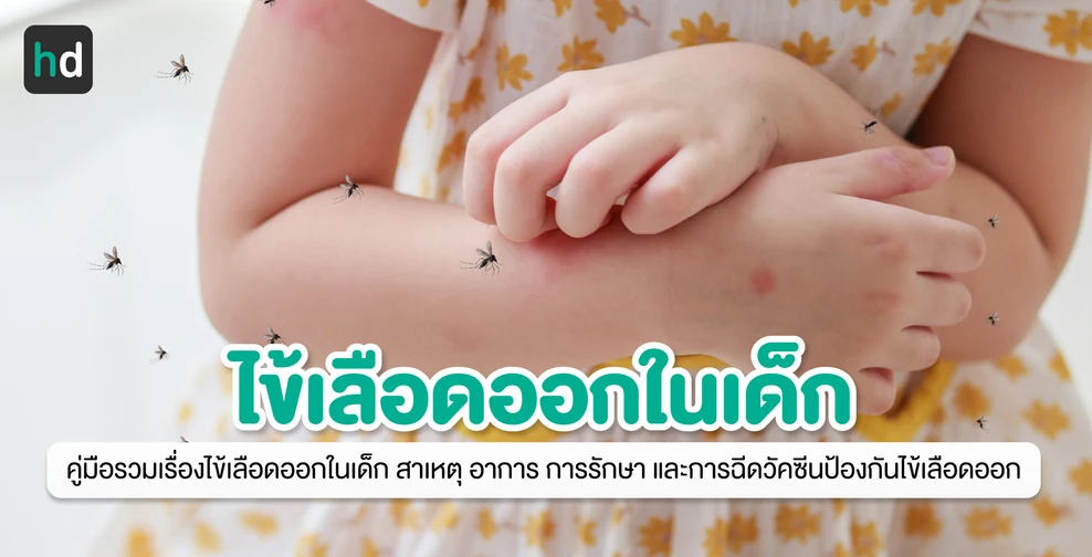 รวมเรื่องไข้เลือดออกในเด็ก ภัยเงียบใกล้ตัวลูก พ่อแม่ควรระวัง