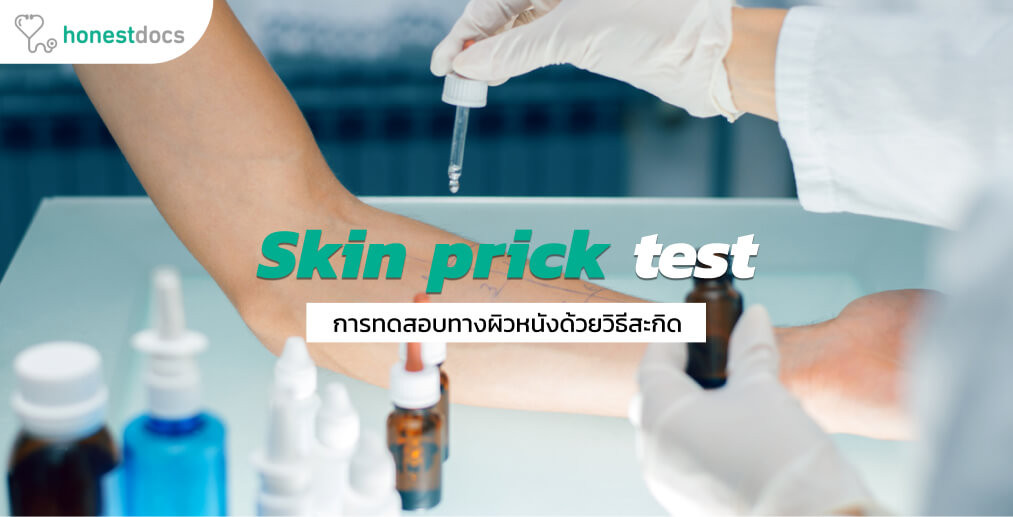 ทดสอบภูมิแพ้ทางผิวหนัง (Skin prick test) คืออะไร? HD สุขภาพดี เริ่มต้นที่นี่