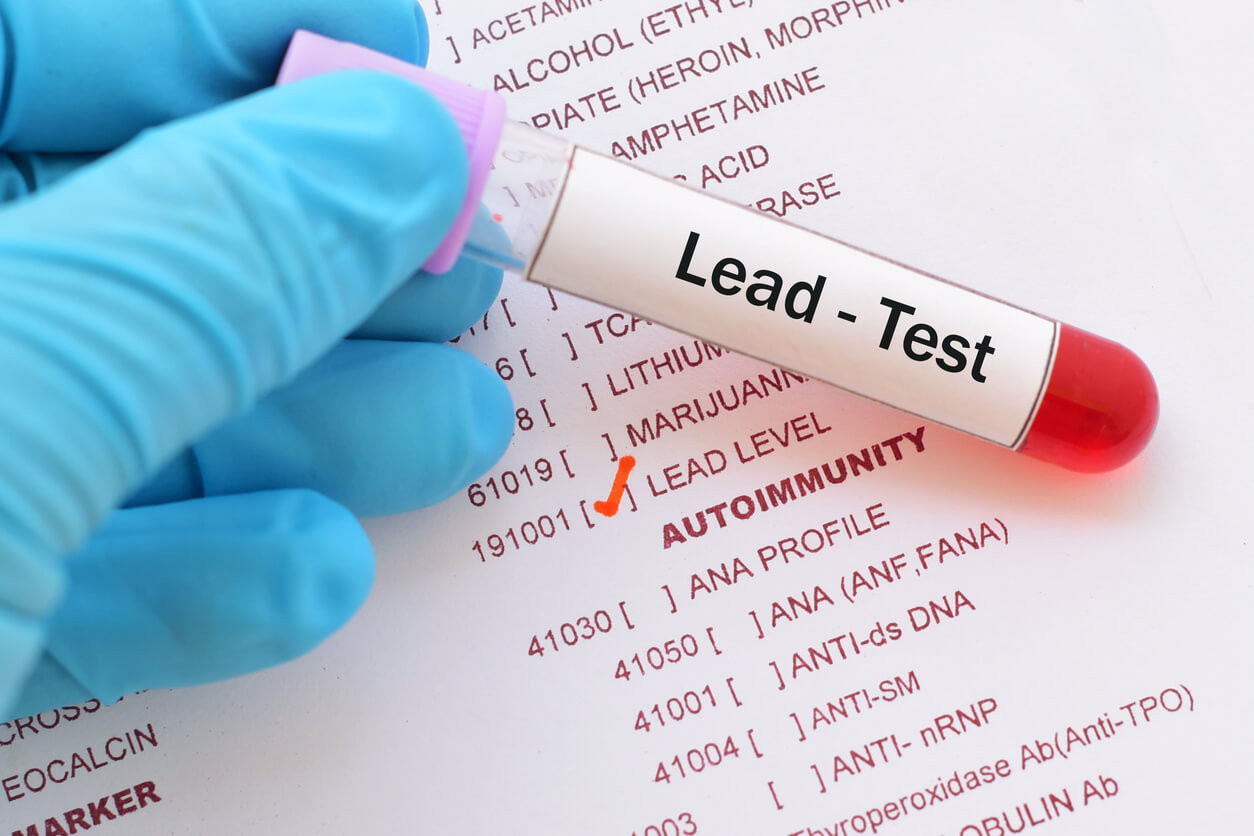 Lead Poisoning: Signs, Symptoms, and Complications