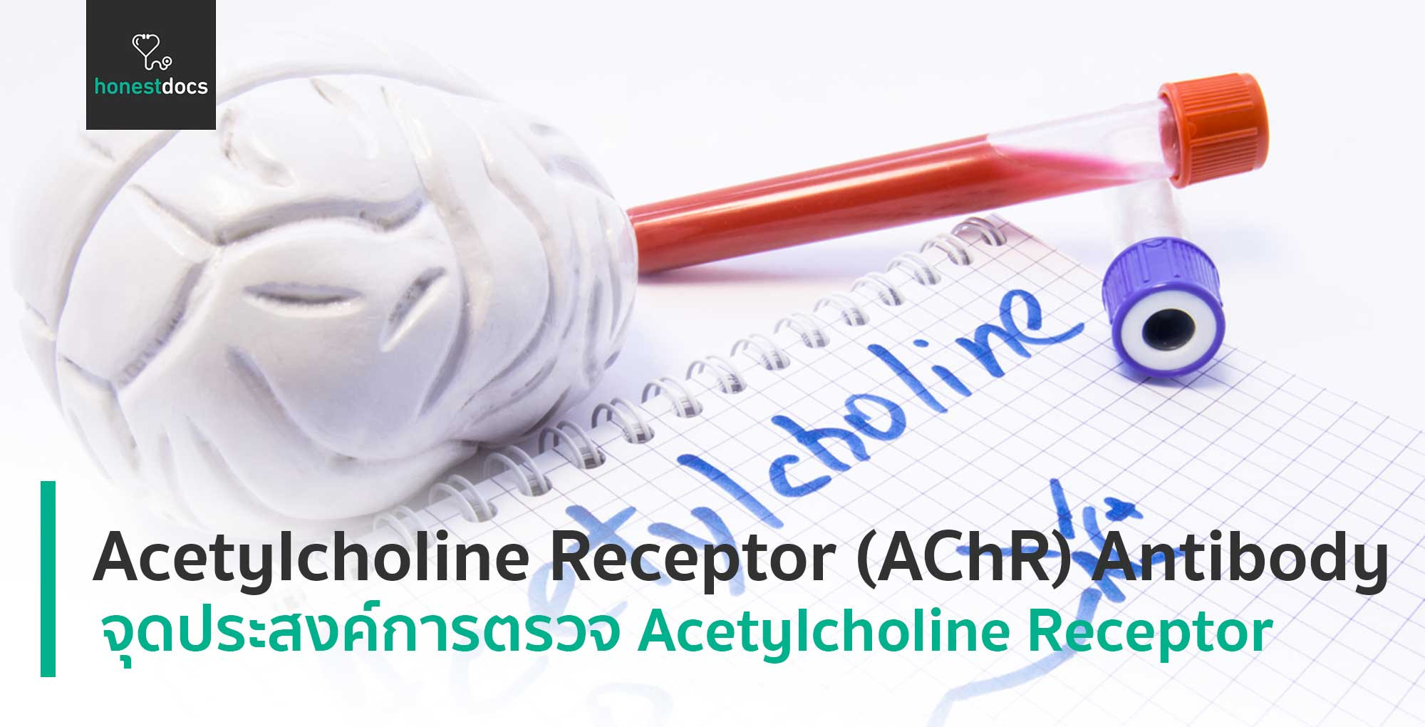 Acetylcholine Receptor (AChR) Antibody HD สุขภาพดี เริ่มต้นที่นี่