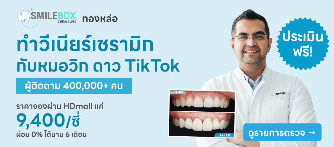 เคลือบฟันและทำวีเนียร์ - SmileBox Dental Clinic