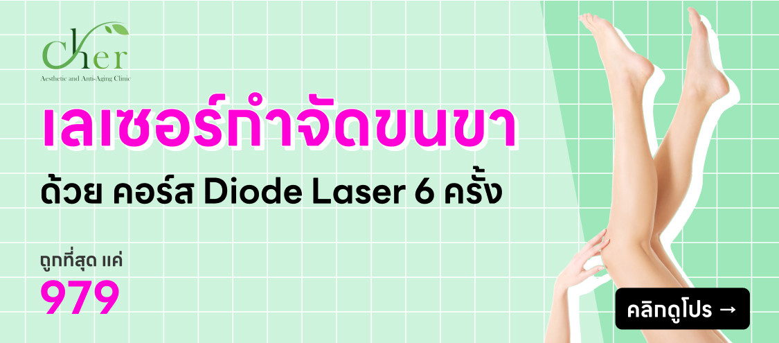Cher Clinic - กำจัดขนขา