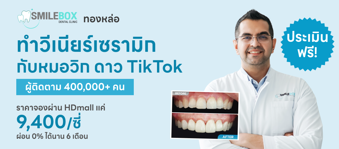 เคลือบฟันและทำวีเนียร์ - SmileBox Dental Clinic