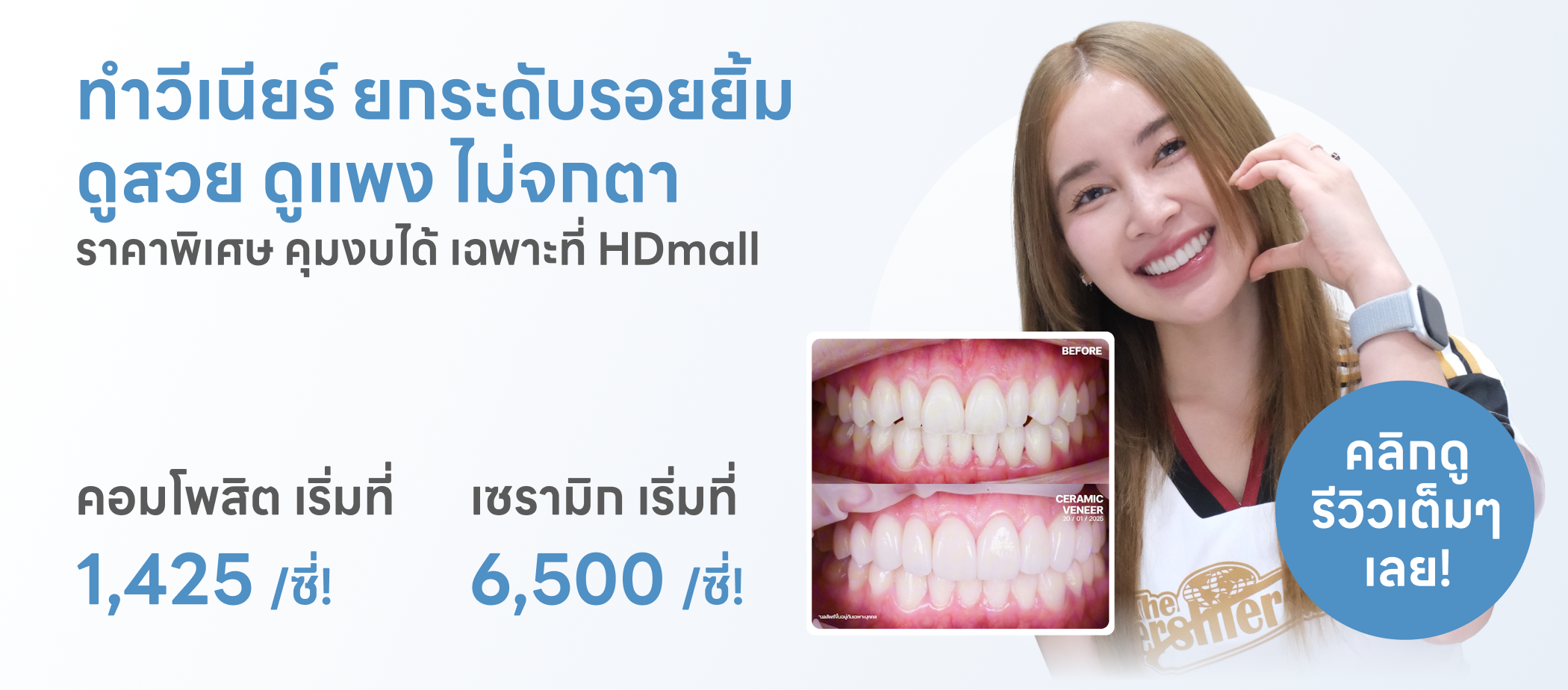 Veneer Ceramic Amber - Tamada