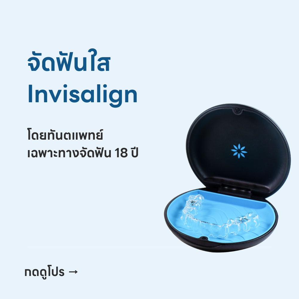 Invisalign