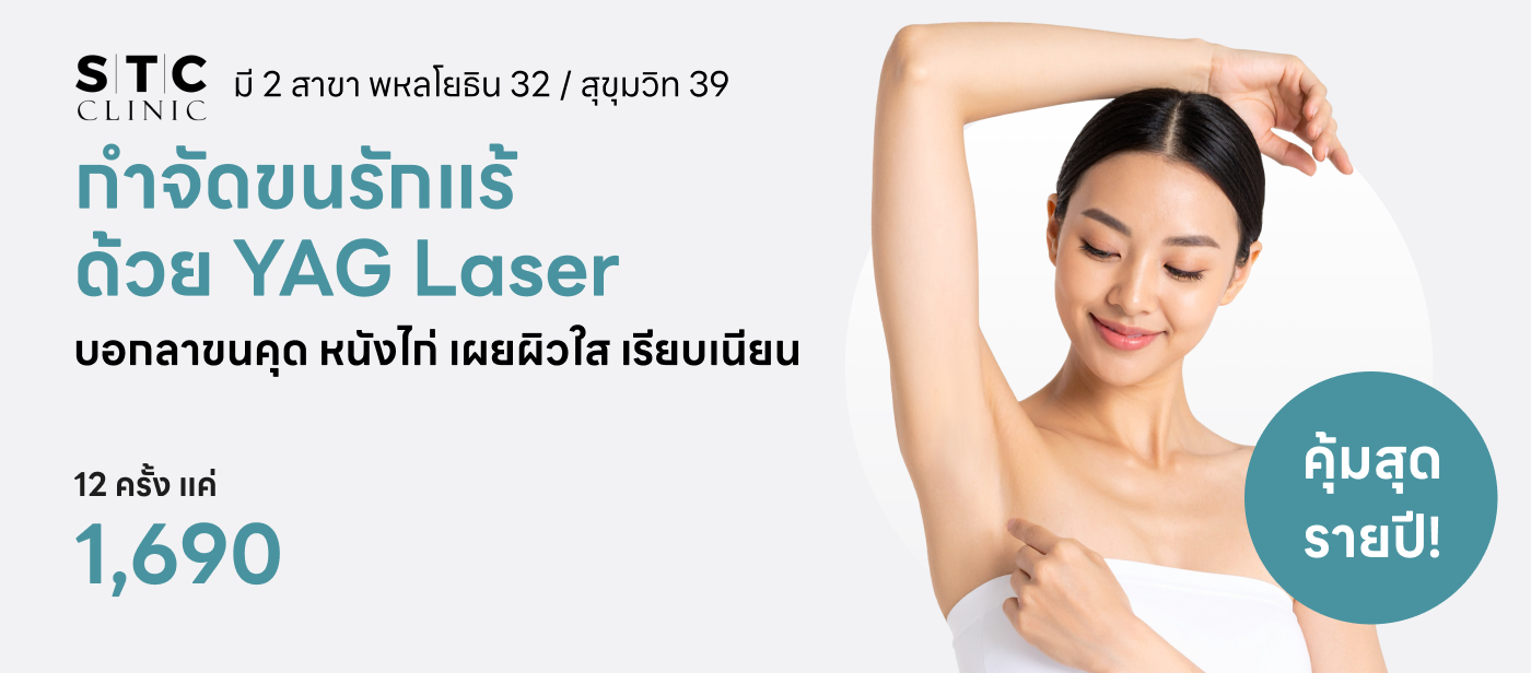 กำจัดขนรักแร้ - STC