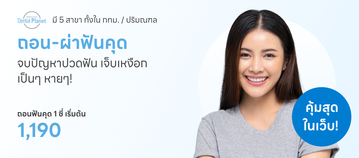 ถอนฟันคุด 1 ซี่