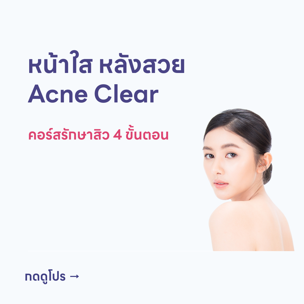 HDmall+ Acne Treatment