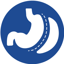 surgeries-section-content-item-img