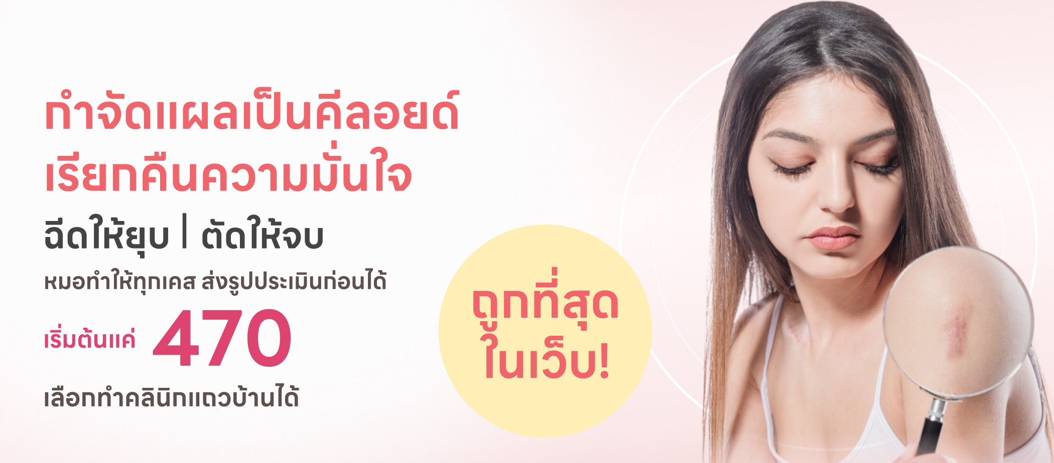 ฉีดคีลอยด์ รักษาเเปลเป็นนูน