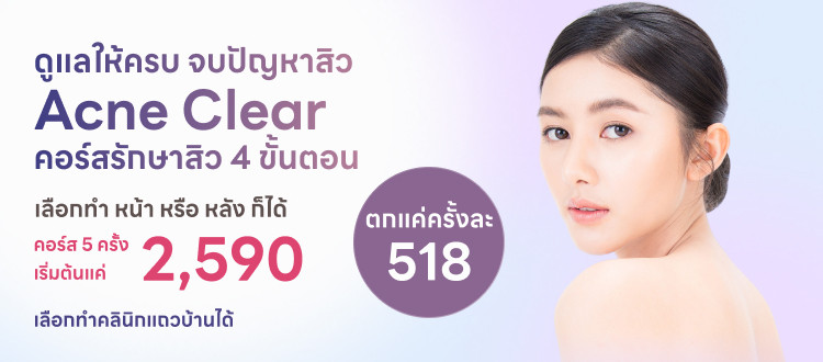 รักษาสิว