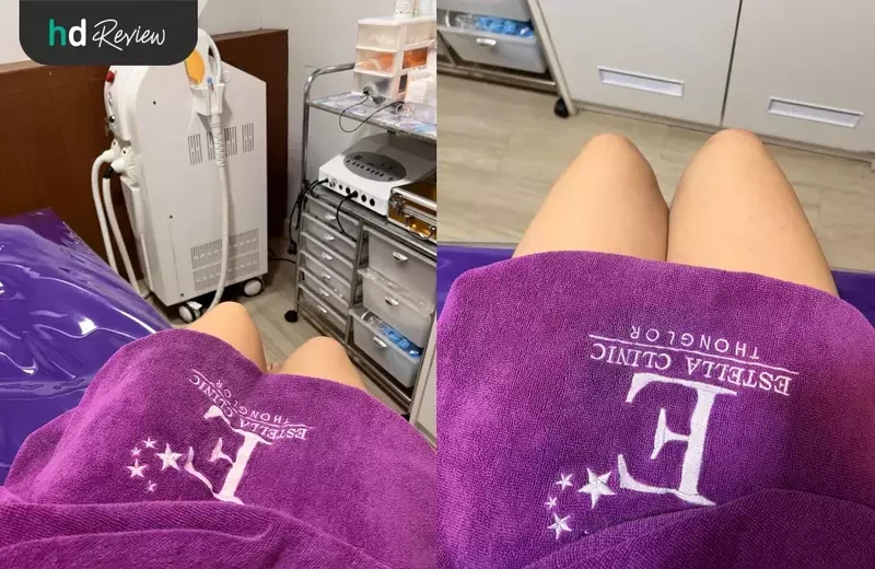 ขั้นตอนการทำ IPL กำจัดขนขา ที่ Estella Clinic