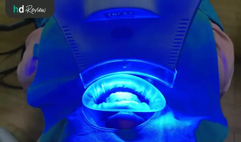 ระหว่างการฟอกสีฟัน ด้วยระบบ Cool Light ที่ Tooth Box Dental Clinic