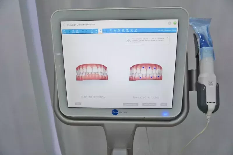 เครื่องสแกนภายในช่องปากแบบ 3 มิติ (Intra Oral Scanner)