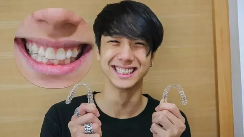 ผู้ใช้บริการจัดฟันแบบใส Crystal Smile ที่ Bangkok Smile Dental