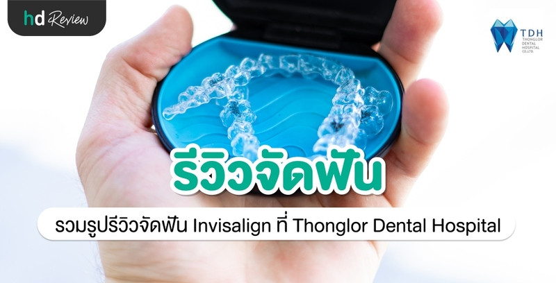 รีวิว จัดฟัน Invisalign ที่ Thonglor Dental Hospital