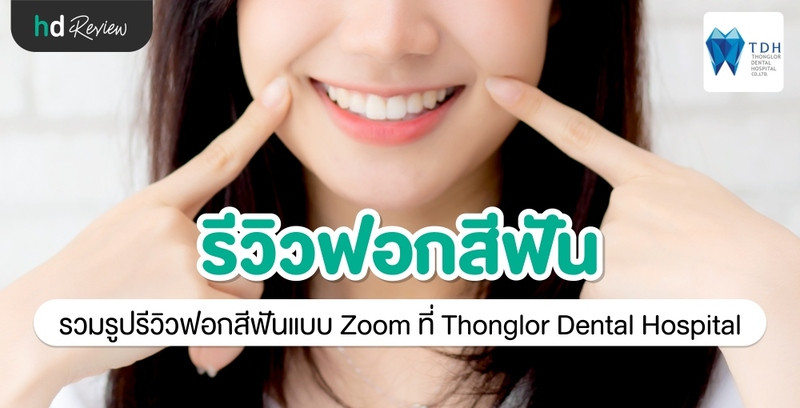 รีวิว ฟอกสีฟันแบบ Zoom ที่ Thonglor Dental Hospital