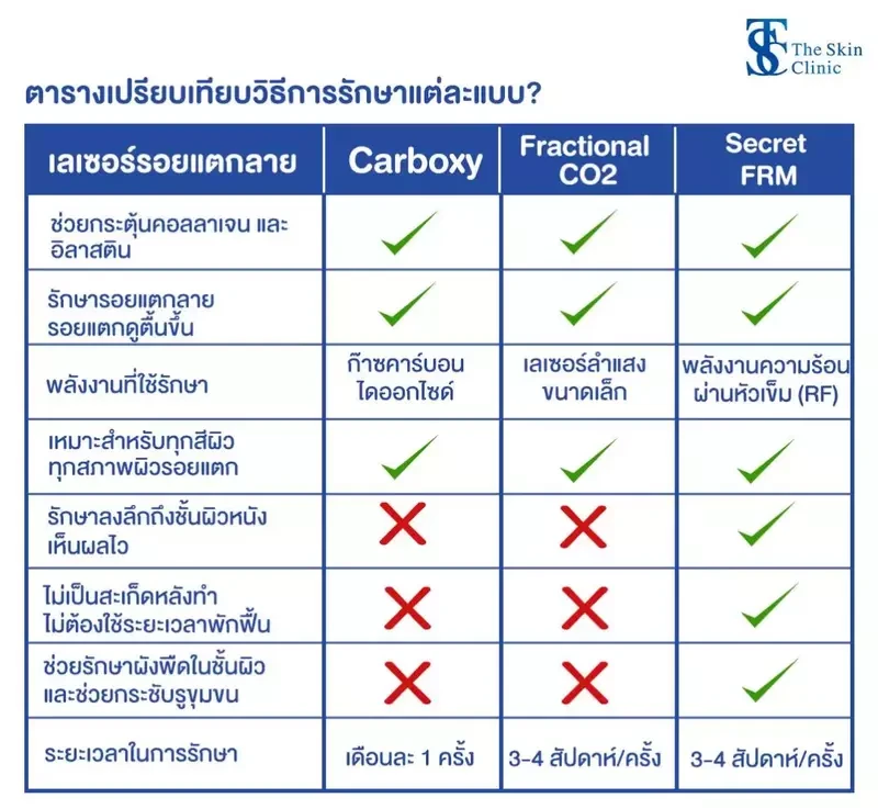 ตารางเปรียบเทียบการรักษารอยแตกลายแต่ละแบบ