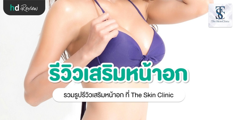 รีวิว เสริมหน้าอก ที่ The Skin Clinic