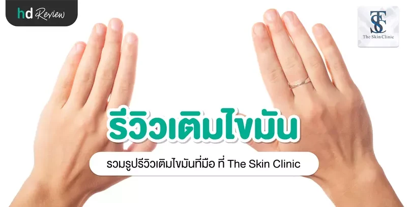 รีวิว เติมไขมันที่มือ ที่ The Skin Clinic