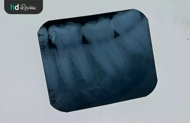 ภาพเอกซเรย์ฟัน ที่ Smart Dental Clinic