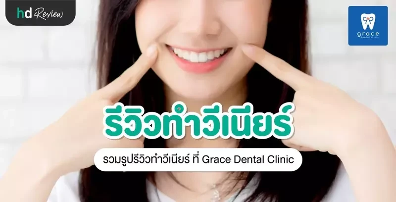 รีวิว ทำวีเนียร์ ที่ Grace Dental Clinic