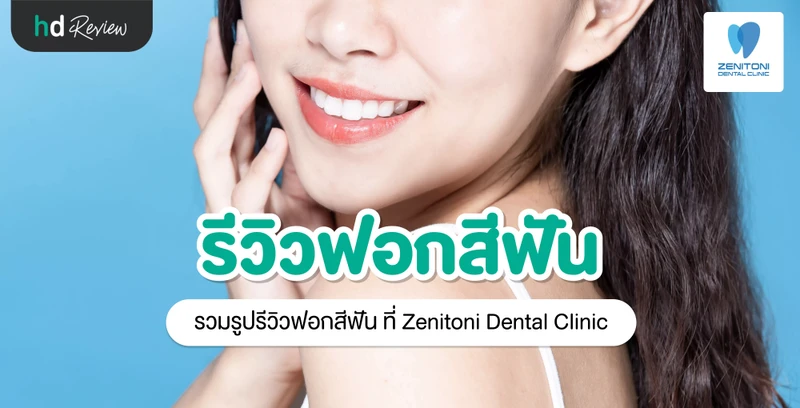 รีวิว ฟอกสีฟัน ที่ Zenitoni Dental Clinic