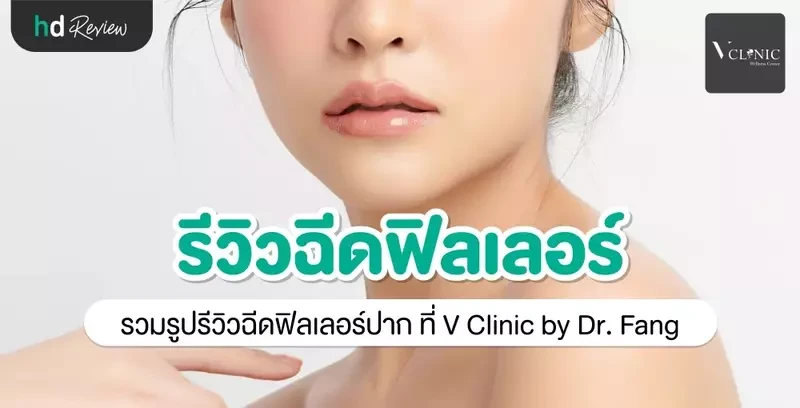 รีวิว ฉีดฟิลเลอร์ปาก ที่ V Clinic by Dr. Fang
