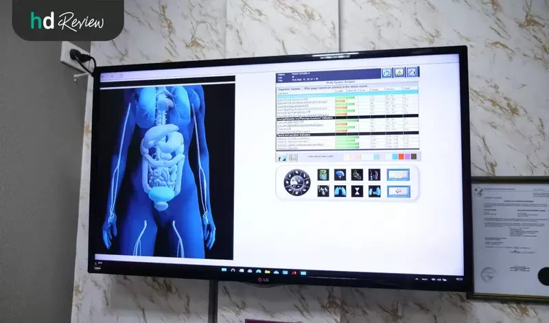 Bio Bodyscan ตรวจสุขภาพด้วยเครื่อง EIS ที่ Bangkok Wellness Medical Clinic