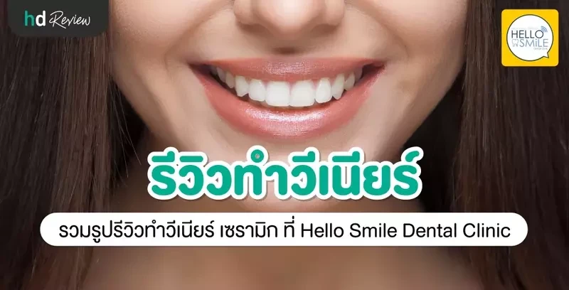 รีวิว ทำวีเนียร์ เซรามิก ที่ Hello Smile Dental Clinic