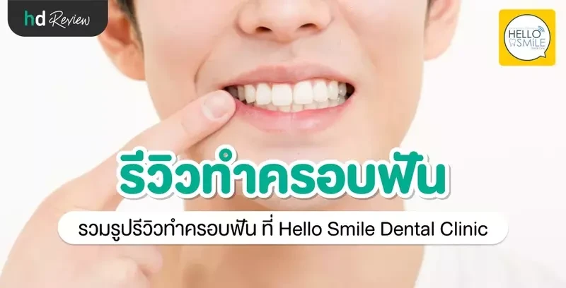 รีวิว ทำครอบฟัน ที่ Hello Smile Dental Clinic