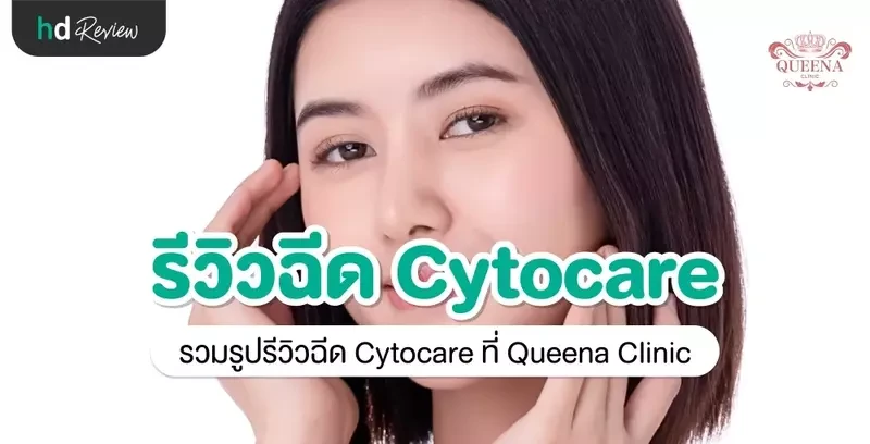 รีวิว ฉีด Cytocare ที่ Queena Clinic