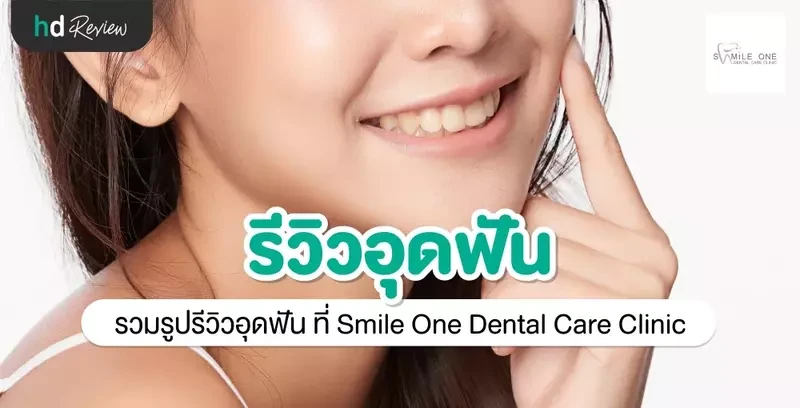 รีวิว อุดฟัน ที่ Smile One Dental Care Clinic