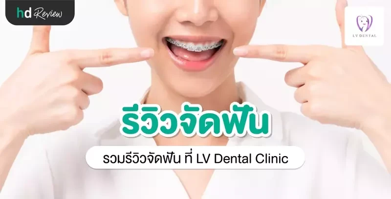 รีวิว จัดฟัน ที่ LV Dental Clinic